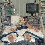 Pediatric Program For Brain Injuries Saves Lives, Reduces Disabilities