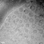 Cryoelectron microscope image